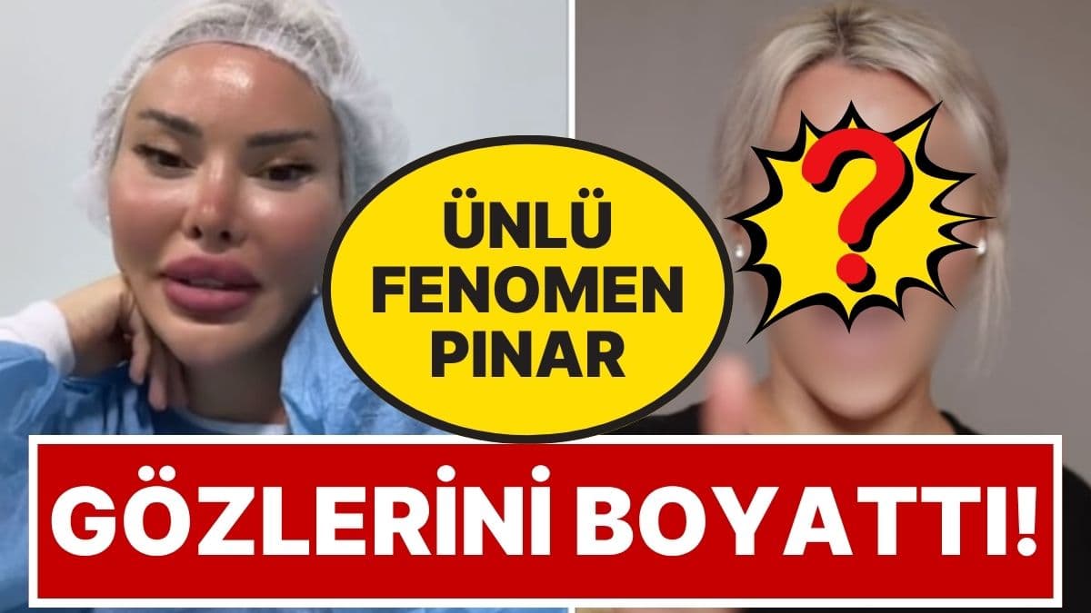 Pınar Özkurteller'in göz rengi değişimi sonrası sosyal medyada yayılan görüntüsü