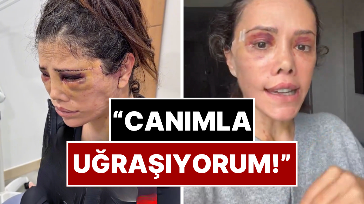 Didem Ceran Estetik Kabusunu Anlattı: Kore Ameliyatı Sonrası Yaşadıkları